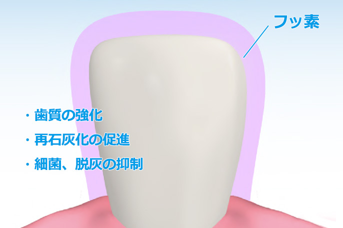 フッ素塗布